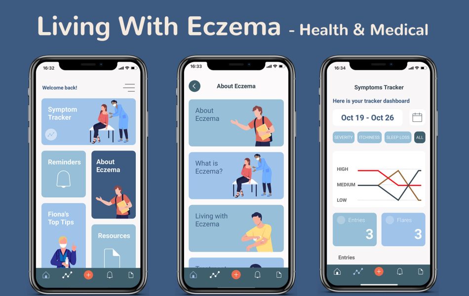 Living With Eczema